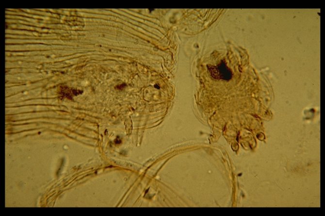 Trachee mijten (Acarapis woodi) onder een microscoop (40x). De structuur links is een trachee van een honingbij.