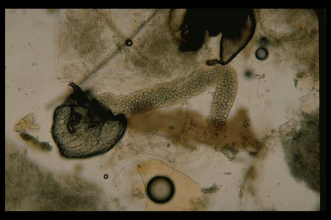 Amoebeziekte (Malpighamoeba mellificae). Microscopisch beeld van een buis van malpighi met amoeben (100x vergroot).