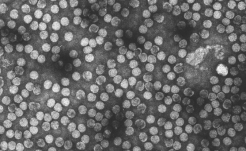 Picorna virus, electronenmicroscoop opnamen