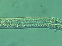 Pratylenchus thornei: vulva region with small empty spermatheca