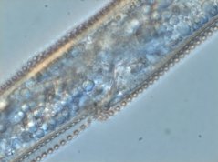 Hemicycliophora thienemanni: vulva & double cuticle layers