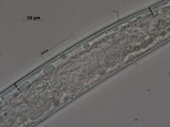 Aglenchus agricola: spermatheca with sperm 