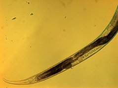 Anatonchus tridentatus: tail region