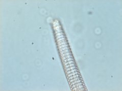 Teratocephalus costatus: cuticule rings 2um