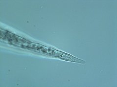 Meloidogyne duytsi: second-stage juvenile tail region 