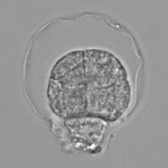 The membrane surrounding the plant embryo. Through a special treatment with enzymes, the embryonic envelope detaches from the embryo, making it clearly visible under a microscope.