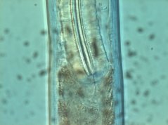 Carcharolaimus banaticus: pharynx-intestine region 