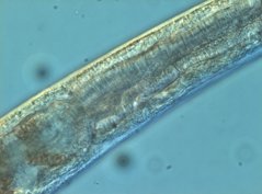 Monhystera paludicola: posterior part of the pharynx
