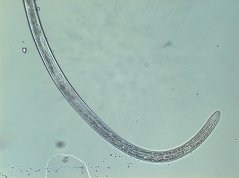 Axonchium propinquum: posterior body 