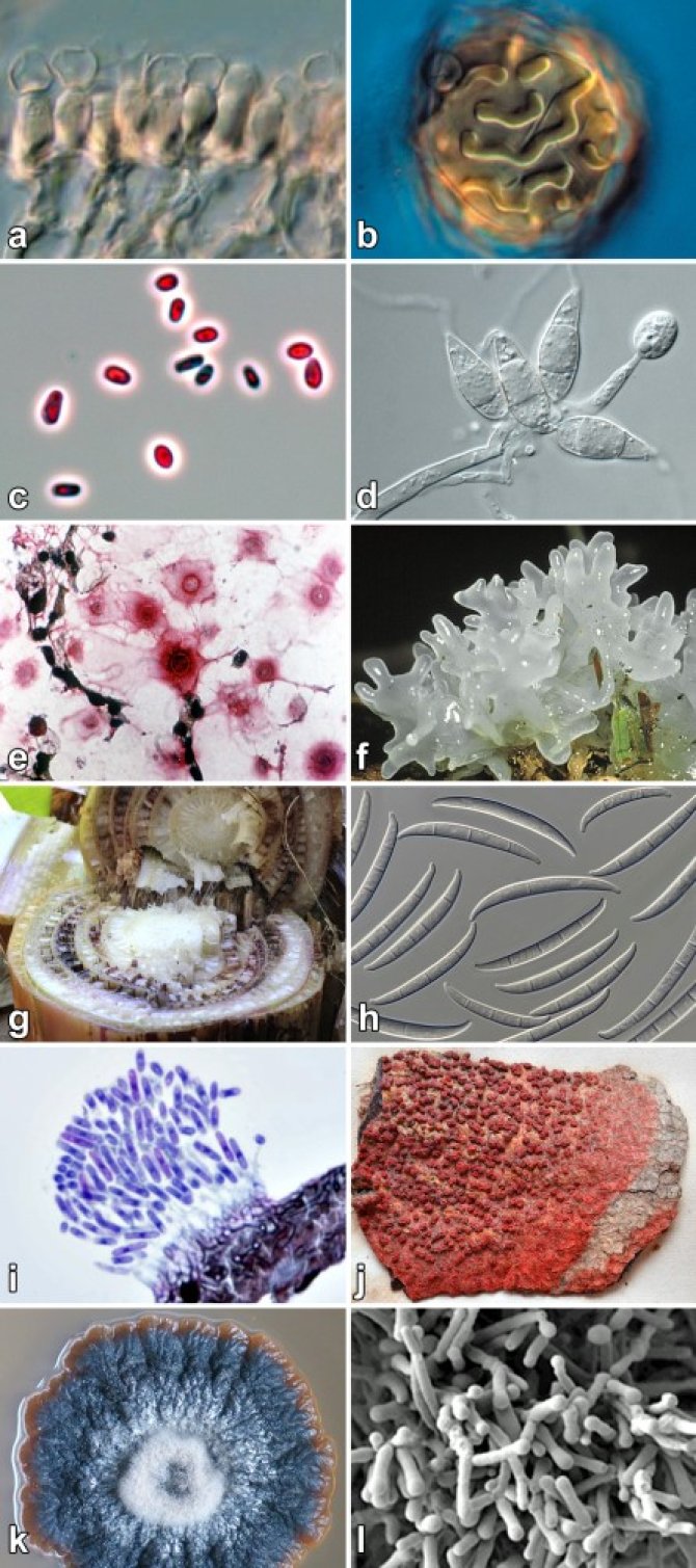 Although Fungi and fungus-like organisms exhibit striking phenotypical diversity, their accurate and precise identification often requires molecular approaches or specific tools such as metabolic profiling, due to widespread cryptic diversification and lack of diagnostic features in microscopic vegetative structures.
