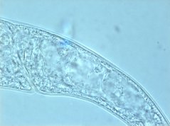 Ascolaimus elongatus: anale opening and posterior part of three rectal glands 