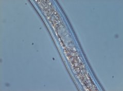Globodera rostochiensis: genital primordium