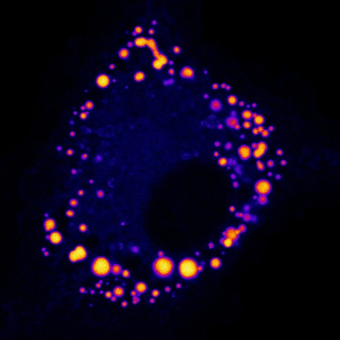 Normale macrofaag met vetophopingen. De vetdruppeltjes zijn fluorescent gekleurd en de foto is gemaakt met een confocale lasermicroscoop. (Foto: Montserrat de la Rosa)