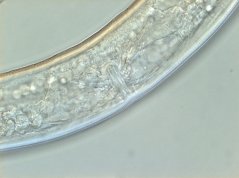 Hirschmanniella gracilis: genital organ amphidelphic