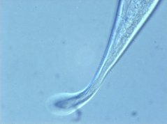 Axonolaimus: tail part