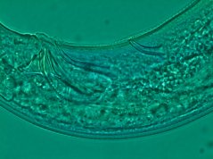 Anaplectus grandepapillatus: tubular supplements and spiculum 