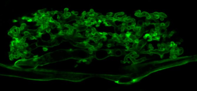 Highly branding AM hyphae (stained green) forming an arbuscule inside a root cortex cell.