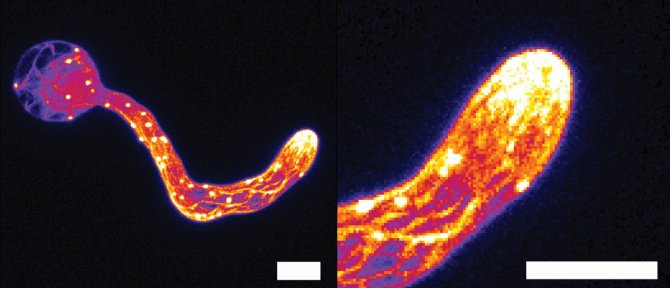 Microscopie-opname van het celskelet van Phytophthora tijdens penetratie van een gastheer laat de zelf-scherpende structuur zien. Links: opname van de gehele cel, rechts: close-up van de aanvals-structuur. Schaalbalk geeft een afstand van 5 micrometer weer