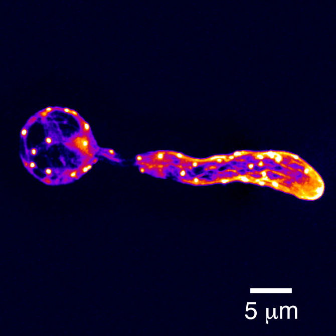 Foto: Microscopische opname van een organisme dat de aardappelziekte veroorzaakt, op het moment van binnendringen van de plant. De foto laat het interne skelet van deze microbe zien. Door dit beter te begrijpen hopen we deze ziekten gerichter te kunnen bestrijden.