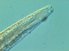 Monhystera paludicola: oral cavity, cephalic setae and anterior part of the pharynx