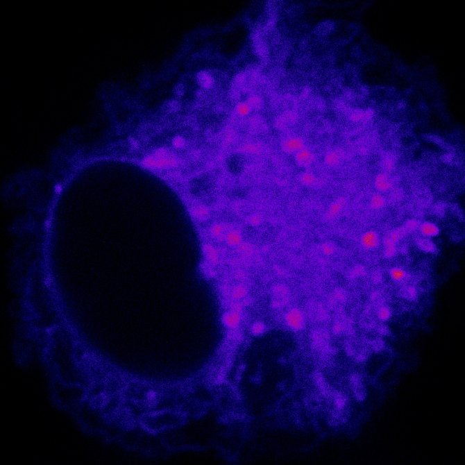 Macrophage without HILPDA, the macrophage no longer stores fat in the droplets. (Photo: Montserrat de la Rosa)