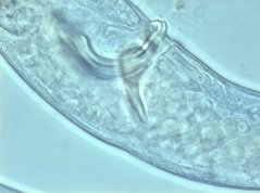 Ascolaimus elongatus: spiculus and gubernaculum (focus on spiculus tip) 