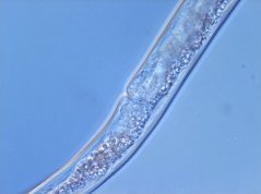 Pratylenchus crenatus: vulva, spermatheca empty