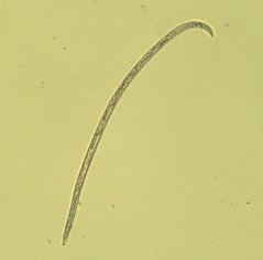Aphelenchoides sp.: male body 