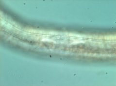 Helicotylenchus pseudorobustus: lateral field 