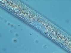 Globodera pallida: genital primordium