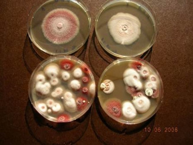 Figure 1: Fusarium oxysporum f.sp. cepae grown on petri dishes.