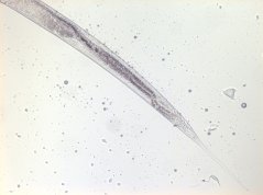 Epitobrilus steineri: tail region