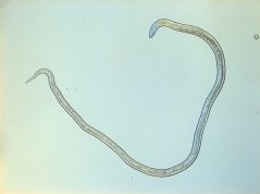 Hirschmanniella gracilis: female body
