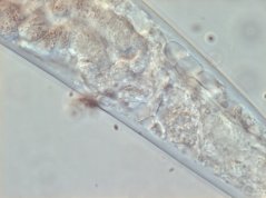 Epitobrilus steineri: anal opening 