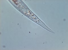 Globodera rostochiensis: anal opening, tail region