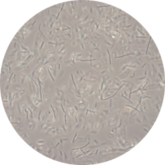 Foto van Clostridium beijerinckii NCIMB 8052 na 24 uur fermentatie, foto Mamou Diallo (FBR)