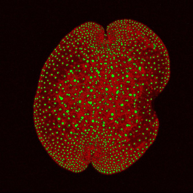 ARF1 protein in Marchantia marked with a fluorescent protein (photo: Shubhajit Das)