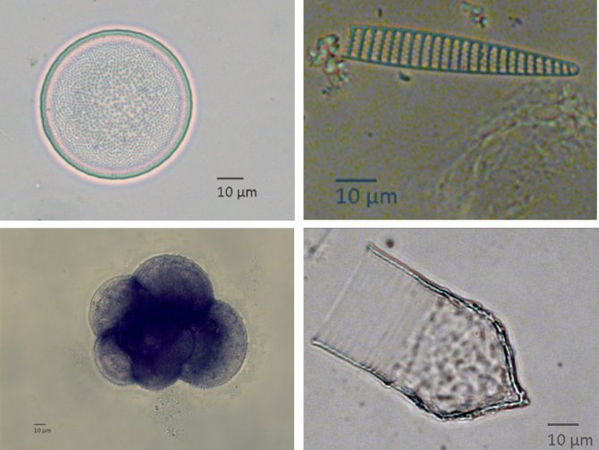 Organismen die in de magen van jonge krill zijn gevonden. Boven: een centrische en een pennate diatomee (algen). Onder: een foraminifeer en de buitenschaal van een tintinnide ciliaat, beiden eencellige organismen.