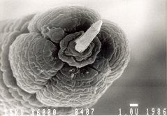 SEM pictures of female head with protruding stylet, four annulated lobes with six annuli and rounded labial disc